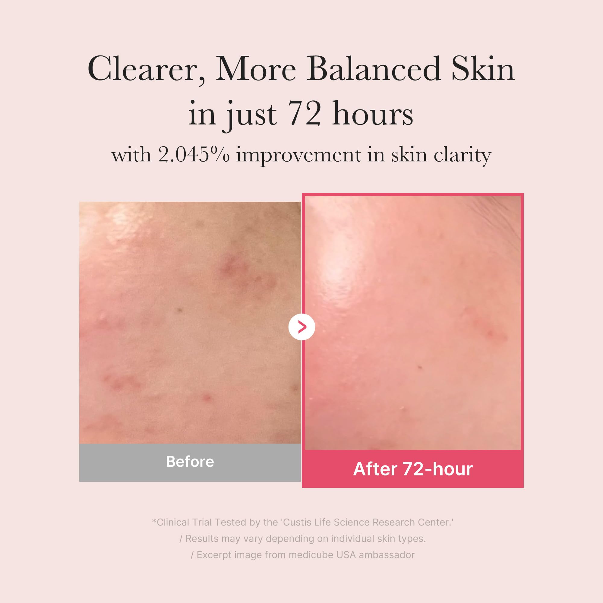 [MEDICUBE] TXA Niacinamide 15 Serum