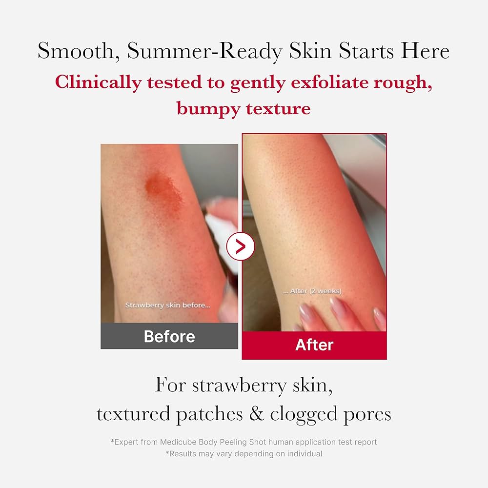 [MEDICUBE] Red Acne Body Peeling Shot