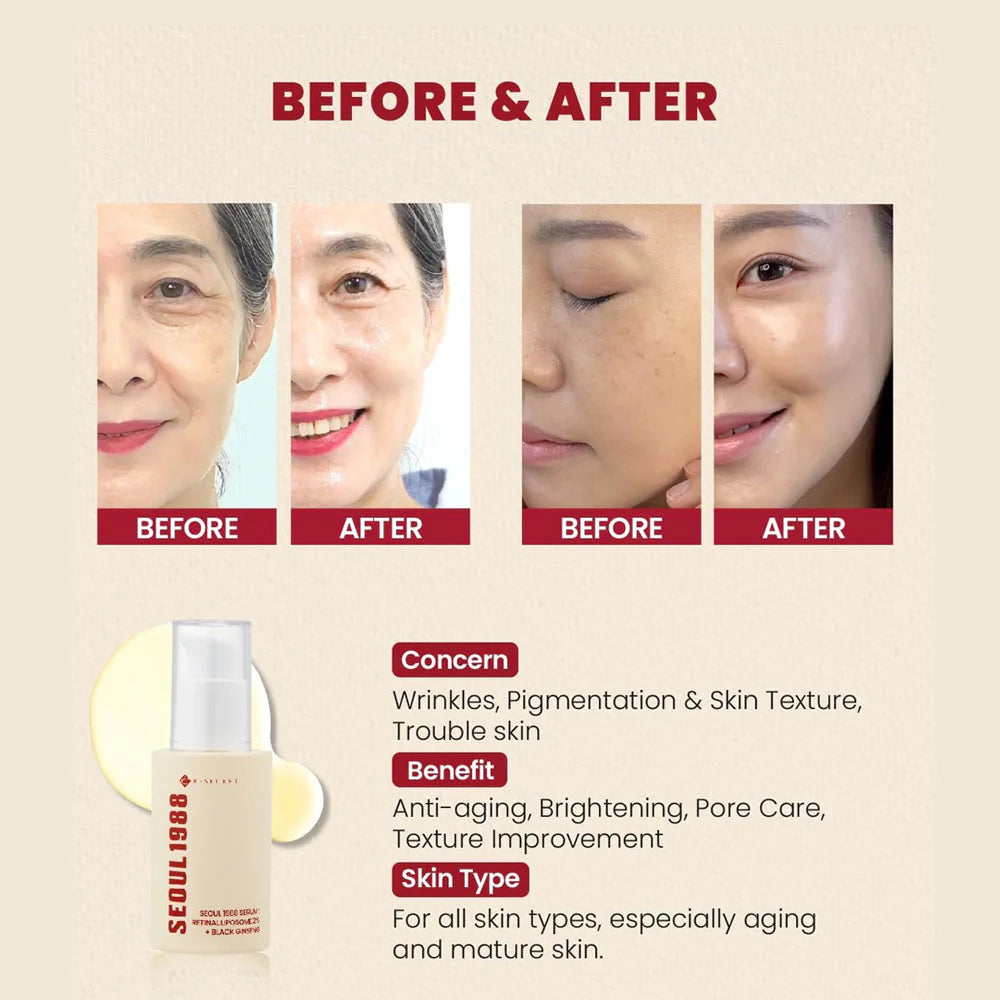[K-SECRET] SEOUL 1988 Serum : Retinal Liposome 2% + Black Ginseng